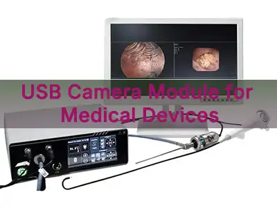 의료 기기용 USB 카메라 모듈: 엔지니어링 선택 가이드